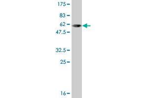 Western Blot detection against Immunogen (58. (SULT1A1 抗体  (AA 1-295))