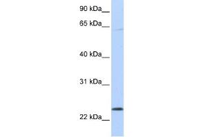 WB Suggested Anti-CHAC1 Antibody Titration: 0. (CHAC1 抗体  (C-Term))