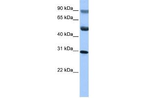 WB Suggested Anti-C17orf39 Antibody Titration: 0. (GID4 抗体  (C-Term))