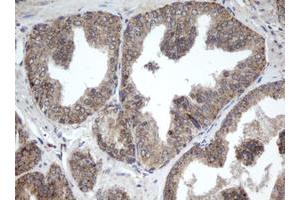 Image no. 1 for anti-Palmitoyl-Protein Thioesterase 1 (PPT1) (AA 100-306) antibody (ABIN1490801) (PPT1 抗体  (AA 100-306))