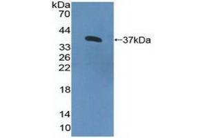 Detection of Recombinant IL8Rb, Human using Polyclonal Antibody to Interleukin 8 Receptor Beta (IL8Rb) (CXCR2 抗体  (AA 1-57))