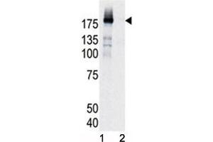 Western blot analysis of phospho-EGFR antibody and HeLa cell lysate, either induced (Lane 1) or noninduced with EGF (2).
