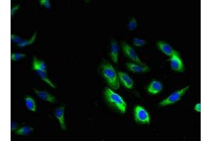 Immunofluorescent analysis of Hela cells using ABIN7154840 at dilution of 1:100 and Alexa Fluor 488-congugated AffiniPure Goat Anti-Rabbit IgG(H+L) (HAX1 抗体  (AA 2-250))