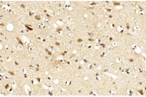 Immunohistochemistry (IHC) image for anti-Leucine Rich Repeat and Ig Domain Containing 1 (LINGO1) (AA 575-603), (C-Term) antibody (ABIN651289)