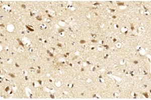 Immunohistochemical analysis of paraffin-embedded Human brain section using LINGO-1(LRRN6A)- (C-term) Antibody (ABIN651289 and ABIN2840172). (LINGO1 抗体  (C-Term))