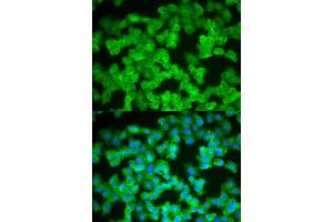 Immunofluorescence (IF) image for anti-S100 Calcium Binding Protein A12 (S100A12) antibody (ABIN1876516)