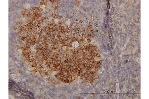 Immunoperoxidase of monoclonal antibody to PHGDH on formalin-fixed paraffin-embedded human lymph node.