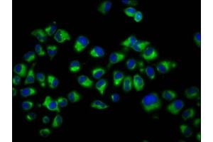 Immunofluorescence staining of Hela cells with ABIN7149086 at 1:200, counter-stained with DAPI. (Cytochrome B Reductase 1 抗体  (AA 220-286))