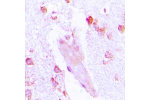 Immunohistochemistry (IHC) image for anti-Carbonic Anhydrase I (CA1) (Center) antibody (ABIN7295054)