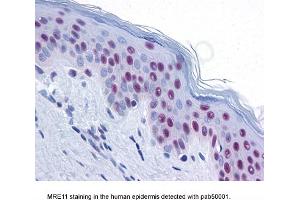 Image no. 2 for anti-MRE11 Meiotic Recombination 11 Homolog A (S. Cerevisiae) (MRE11A) antibody (ABIN363310) (Mre11 抗体)