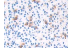 DAB staining on IHC-P; Samples: Rat Adrenal gland Tissue (TBX3 抗体  (AA 107-220))