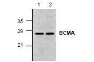 Image no. 1 for anti-Tumor Necrosis Factor Receptor Superfamily, Member 17 (TNFRSF17) (C-Term) antibody (ABIN127204) (BCMA 抗体  (C-Term))