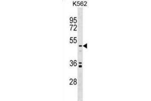 Western Blotting (WB) image for anti-Uronyl-2-Sulfotransferase (UST) antibody (ABIN2999336)