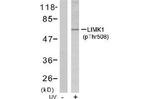 Image no. 2 for anti-LIM Domain Kinase 1 (LIMK1) (pThr508) antibody (ABIN196831) (LIM Domain Kinase 1 抗体  (pThr508))