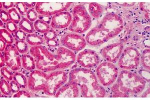 Human Kidney: Formalin-Fixed, Paraffin-Embedded (FFPE) (APOA2 抗体)