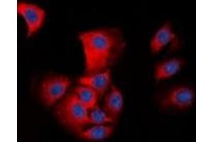 Immunofluorescent analysis of ASC staining in HepG2 cells. (STS 抗体  (N-Term))