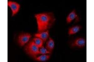 Immunofluorescent analysis of ASC staining in HepG2 cells.