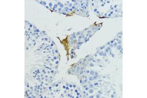 Immunohistochemistry of paraffin-embedded mouse testis using KLKB1 antibody (ABIN6129406, ABIN6142965, ABIN6142967 and ABIN6217272) at dilution of 1:200 (40x lens). (KLKB1 抗体  (AA 20-300))