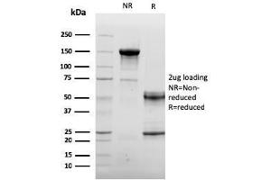 SDS-PAGE Analysis Purified Endoglin / CD105 Mouse Monoclonal Antibody (ENG/3269). (Endoglin 抗体  (AA 74-251))