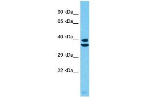 Western Blotting (WB) image for anti-Protease, Serine, 55 (PRSS55) (C-Term) antibody (ABIN2774576) (PRSS55 抗体  (C-Term))