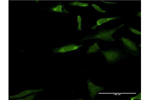 Immunofluorescence of monoclonal antibody to MAPK3 on HeLa cell. (ERK1 抗体  (AA 279-379))
