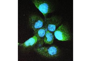 anti-Alcohol Dehydrogenase 5 (Class III), chi Polypeptide (ADH5) (AA 212-374) antibody