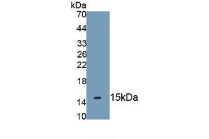 Detection of Recombinant KRT2, Human using Monoclonal Antibody to Keratin 2 (CK2) (Keratin 2 抗体  (AA 7-160))