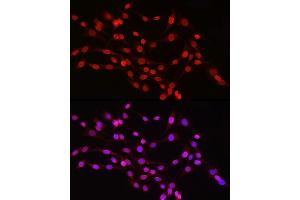 Immunofluorescence analysis of PC-12 cells using Lamin B1 Rabbit pAb (ABIN3015697, ABIN3015698, ABIN3015699, ABIN1680700 and ABIN6219049) at dilution of 1:150 (40x lens). (Lamin B1 抗体  (AA 397-586))