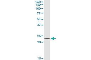 GUK1 MaxPab rabbit polyclonal antibody. (GUK1 抗体  (AA 1-197))