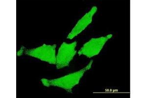 Image no. 1 for anti-Receptor tyrosine-protein kinase erbB-2 (ErbB2/Her2) (AA 22-122) antibody (ABIN599374) (ErbB2/Her2 抗体  (AA 22-122))