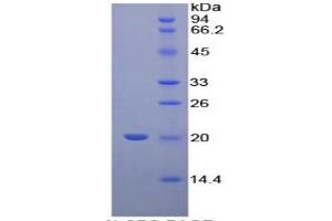 SDS-PAGE of Protein Standard from the Kit  (Highly purified E.