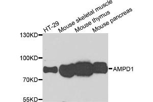 Western blot analysis of extracts of various cell lines, using AMPD1 antibody (ABIN5995393) at 1/1000 dilution. (AMPD1 抗体)