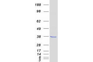 Validation with Western Blot