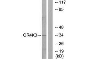 Western blot analysis of extracts from Jurkat cells, using OR4K3 Antibody. (OR4K3 抗体  (AA 266-315))
