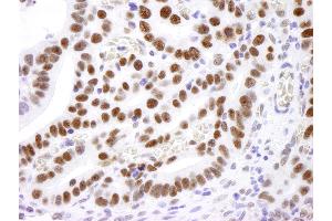 Immunohistochemistry (IHC) image for anti-Nucleolin (NCL) (AA 250-300) antibody (ABIN7454667)