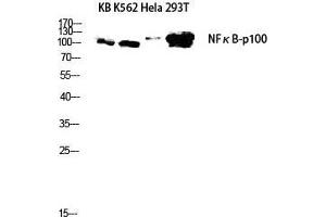 Western Blot (WB) analysis of KB K562 HeLa 293T lysis using NFkappaB-p100 antibody. (NFKB2 抗体  (Thr160))