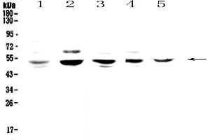 Western blot analysis of NFIB/NF1B2 using anti-NFIB/NF1B2 antibody . (NFIB 抗体)