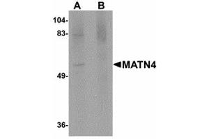 Image no. 1 for anti-Matrilin 4 (MATN4) (N-Term) antibody (ABIN478066) (MATN4 抗体  (N-Term))