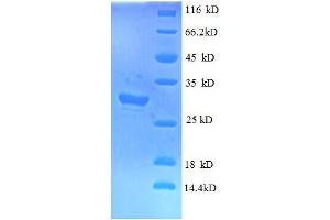 Interferon-Induced Transmembrane Protein 1 (IFITM1) (AA 1-36) protein (GST tag) (IFITM1 Protein (AA 1-36) (GST tag))