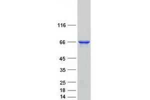 Western Blotting (WB) image for Optineurin (OPTN) (Transcript Variant 1) protein (Myc-DYKDDDDK Tag) (ABIN2727924)