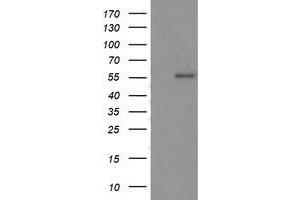 Western Blotting (WB) image for anti-Tumor Protein P53 (TP53) antibody (ABIN1499967) (p53 抗体)
