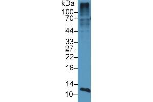 Detection of S100A4 in Mouse Placenta lysate using Polyclonal Antibody to S100 Calcium Binding Protein A4 (S100A4) (s100a4 抗体  (AA 1-101))