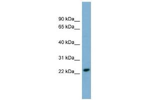 KLRC3 antibody used at 1 ug/ml to detect target protein.