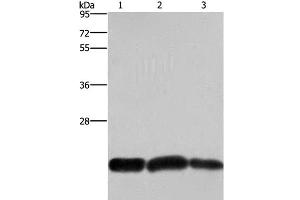 Western Blot analysis of A375 and Raji cell, Human fetal brain tissue using CBX3 Polyclonal Antibody at dilution of 1:600 (CBX3 抗体)