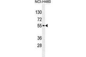 Western blot analysis in NCI-H460 cell line lysates (35ug/lane) using MIER2 Antibody (N-term). (MIER2 抗体  (N-Term))