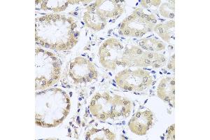 Immunohistochemistry of paraffin-embedded human stomach using CGB7 antibody at dilution of 1:100 (x40 lens). (CGB7 抗体)