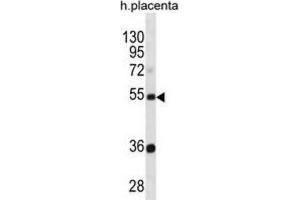 Western Blotting (WB) image for anti-Tektin 3 (TEKT3) antibody (ABIN3000961) (Tektin 3 抗体)