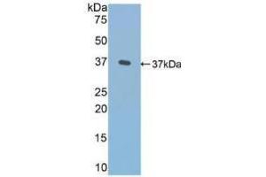 Western blot analysis of recombinant Human FN. (Fibronectin 抗体  (AA 313-607))