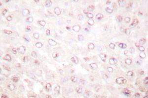 Image no. 1 for anti-K(lysine) Acetyltransferase 2B (KAT2B) antibody (ABIN271904) (KAT2B 抗体)