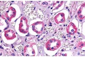 Immunohistochemistry (Formalin/PFA-fixed paraffin-embedded sections) of human kidney, renal tubules with TAAR6 polyclonal antibody . (TAAR6 抗体  (Cytoplasmic Domain))
